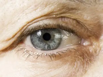 Imagen de un ojo Imagen de un ojo