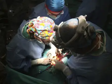 Imagen de un quirófano durante un trasplante de corazón Imagen de un quirófano durante un trasplante de corazón