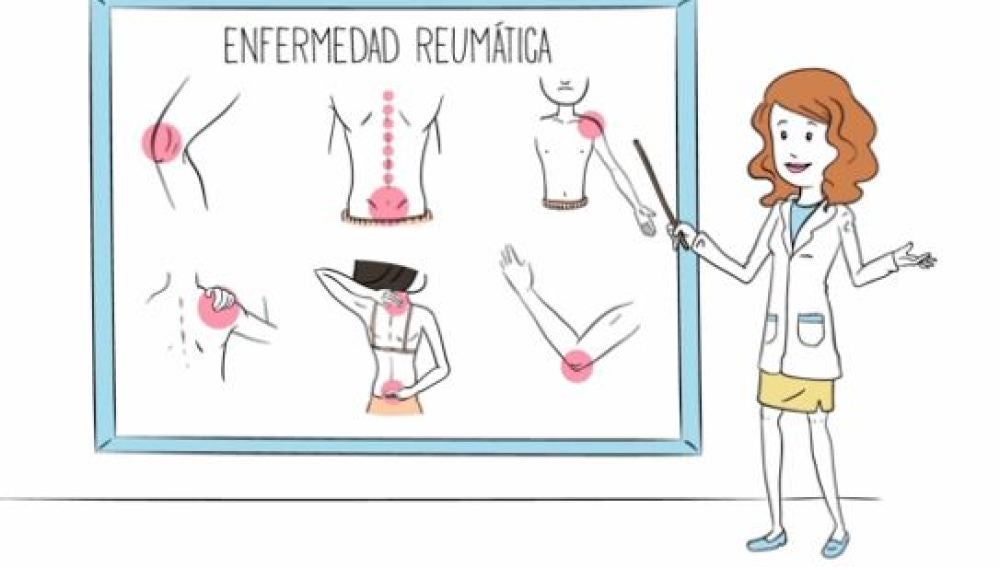 La Sociedad Española de Reumatología lanza un vídeo para concienciar sobre las enfermedad reumáticas 