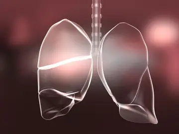 El ejercicio en hipoxia moderada es saludable para pacientes con EPOC El ejercicio en hipoxia moderada es saludable para pacientes con EPOC