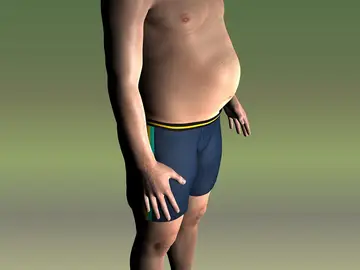 Obesidad en hombres Obesidad en hombres