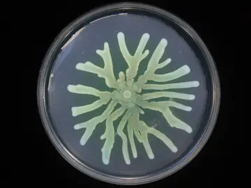 Asi mejoran su supervivencia las bacterias resistentes a antibioticos Asi mejoran su supervivencia las bacterias resistentes a antibioticos