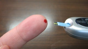 La glucosa podría regularse con injertos de piel La glucosa podría regularse con injertos de piel