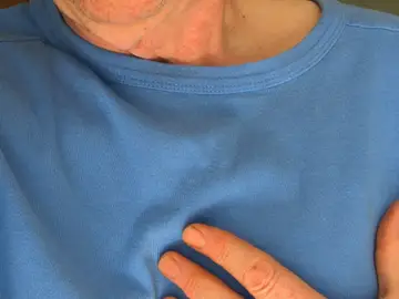 Infarto Infarto