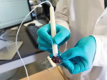 Un dispositivo identifica en segundos el tejido canceroso durante la cirugia Un dispositivo identifica en segundos el tejido canceroso durante la cirugia