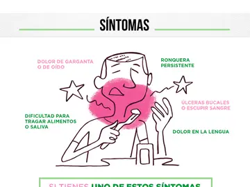 Infografía: Cáncer de cabeza y cuello Infografía: Cáncer de cabeza y cuello