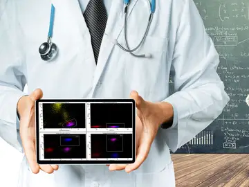 Matemáticas para evitar las recaídas en leucemia infantil Matemáticas para evitar las recaídas en leucemia infantil