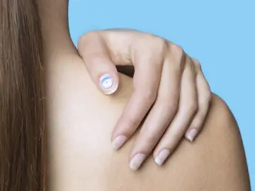 Desarrollan un sensor que se adhiere a la uña del pulgar para medir la exposición a los rayos UV Desarrollan un sensor que se adhiere a la uña del pulgar para medir la exposición a los rayos UV