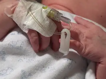 Carla, primer bebé español en recibir un corazón incompatible con su sangre Carla, primer bebé español en recibir un corazón incompatible con su sangre