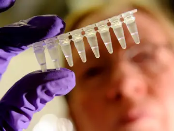 Los avances relacionados con la detección del VIH son constantes. Esta semana ha llegado a las farmacias españolas la prueba para el autodiagnóstico en casa sin necesidad de prescripción médica. Antes, un equipo de científicos ha desarrollado una cápsula para administrar los fármacos contra el VIH de una semana. Los avances relacionados con la detección del VIH son constantes. Esta semana ha llegado a las farmacias españolas la prueba para el autodiagnóstico en casa sin necesidad de prescripción médica. Antes, un equipo de científicos ha desarrollado una cápsula para administrar los fármacos contra el VIH de una semana.