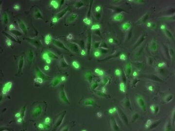 Células donde las mitocondrias aparecen teñidas de verde Células donde las mitocondrias aparecen teñidas de verde