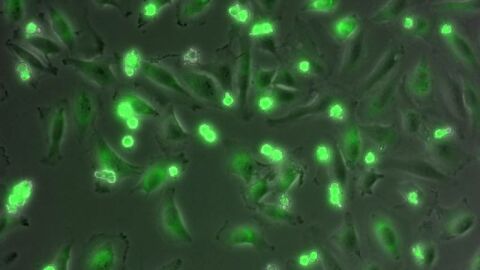 Células donde las mitocondrias aparecen teñidas de verde