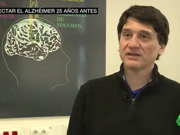 alzheimer alzheimer