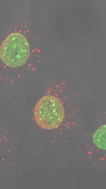 El estrés del ADN mitocondrial (en rojo) inicia la respuesta inflamatoria en ausencia de Opa1 en células musculares de ratón (en verde, los núcleos) El estrés del ADN mitocondrial (en rojo) inicia la respuesta inflamatoria en ausencia de Opa1 en células musculares de ratón (en verde, los núcleos)
