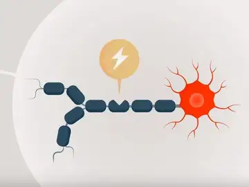 ¿Qué es la esclerosis múltiple? ¿Qué es la esclerosis múltiple?