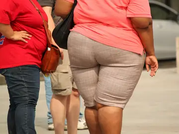 Obesidad en España Obesidad en España