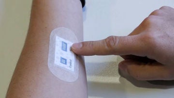 Un nuevo parche para la piel facilita el diagnostico de la fibrosis quistica