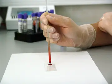 Análisis de una muestra de sangre en un laboratorio Análisis de una muestra de sangre en un laboratorio
