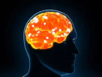 Cerebro Cerebro