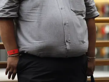 Un hombre con obesidad Un hombre con obesidad