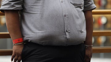 Un hombre con obesidad Un hombre con obesidad