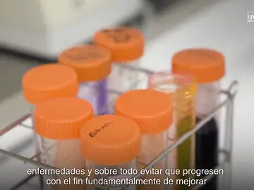 Mantener el Biobanco de enfermedades renales Mantener el Biobanco de enfermedades renales