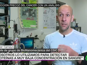 Un análisis de sangre podría detectar el cáncer de forma precoz Un análisis de sangre podría detectar el cáncer de forma precoz