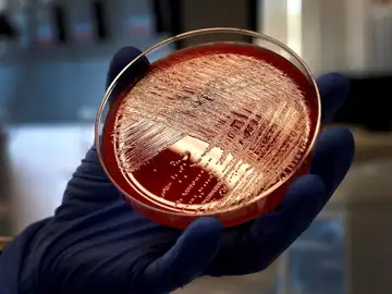 Nuevos fármacos para el cáncer de mama Nuevos fármacos para el cáncer de mama