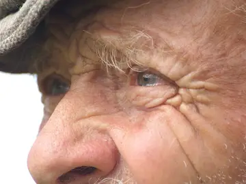 Ojos de un anciano Ojos de un anciano