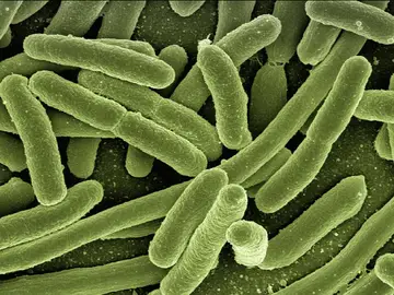 Bacterias Bacterias