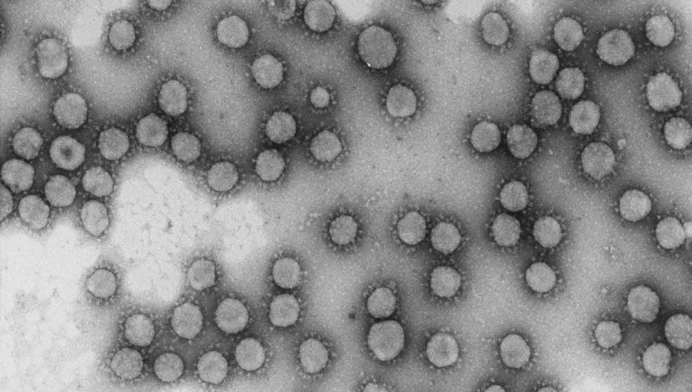 Virus de la familia Coronaviridae
