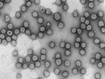 Virus de la familia Coronaviridae Virus de la familia Coronaviridae