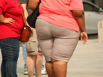 Persona con obesidad Persona con obesidad