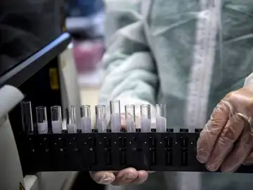 Un médico manipula unas muestras en un laboratorio Un médico manipula unas muestras en un laboratorio