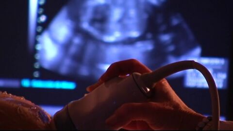 Edema de piel en fetos de mujeres embarazadas, el nuevo síntoma del coronavirus