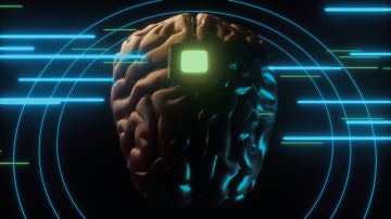 'Neuroderechos' 'Neuroderechos'