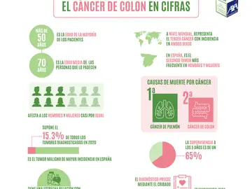 El cáncer de colon en cifras El cáncer de colon en cifras