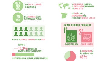 El cáncer de colon en cifras
