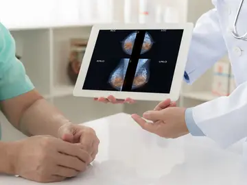 Cáncer de mama Cáncer de mama