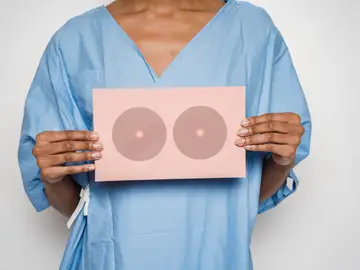 Cáncer de mama Cáncer de mama