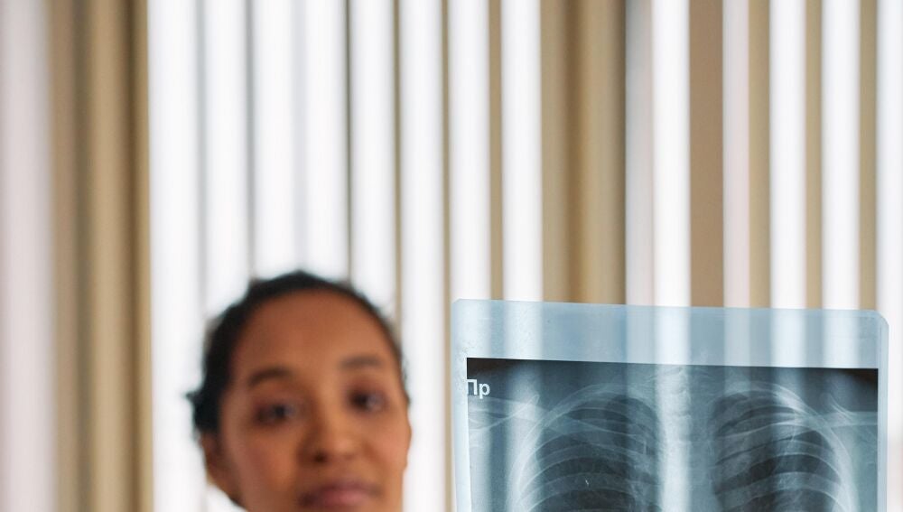 Radiografía pulmonar