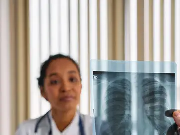 Radiografía pulmonar Radiografía pulmonar