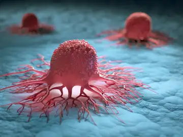 Asi permanecen dormidas las celulas tumorales antes de provocar la metastasis Asi permanecen dormidas las celulas tumorales antes de provocar la metastasis