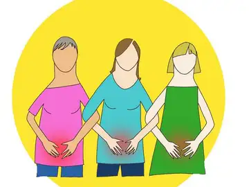 Colabora con esta investigación que busca nuevas terapias para la endometriosis Colabora con esta investigación que busca nuevas terapias para la endometriosis
