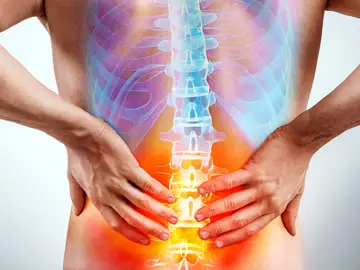 Proyecto científico para prevenir la lumbalgia crónica a través de un sistema predictivo Proyecto científico para prevenir la lumbalgia crónica a través de un sistema predictivo