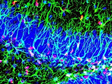 Descubierto un nuevo mecanismo para activar las celulas madre del cerebro adulto