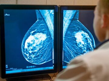 médico revisando una mamografía