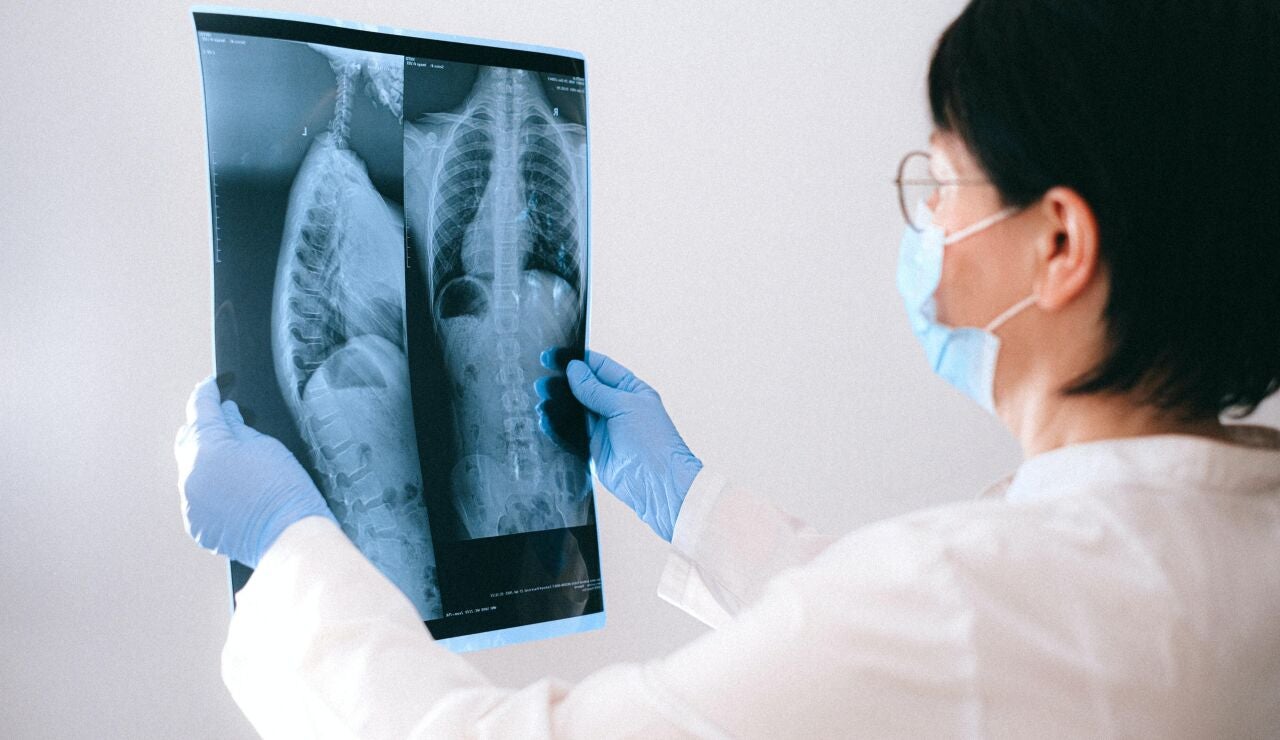 Minipulmones generados en laboratorio para avanzar en el estudio del neumococo 