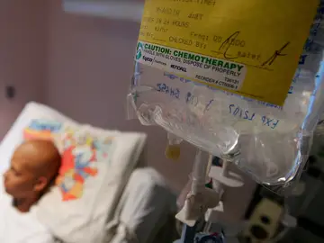 El síntoma que alerta de la Leucemia Mieloide Crónica El síntoma que alerta de la Leucemia Mieloide Crónica