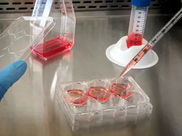 ¿Es posible crear células madre sanguíneas de forma artificial? ¿Es posible crear células madre sanguíneas de forma artificial?